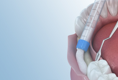 Bone augmentation