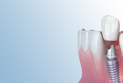 Prosthetics